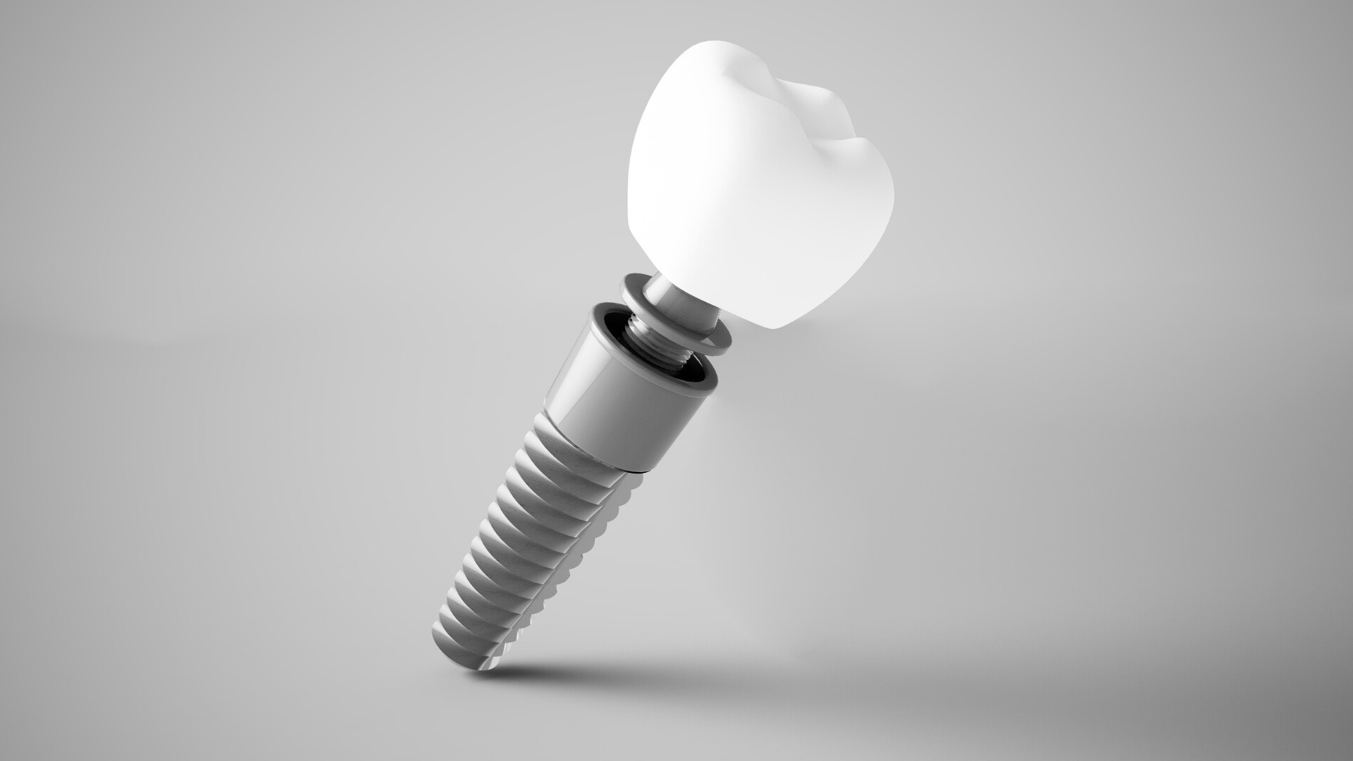dental implantlarda yeni trend metal icermeyen cozumler Dental İmplantlarda Yeni Trend: Metal İçermeyen Çözümler