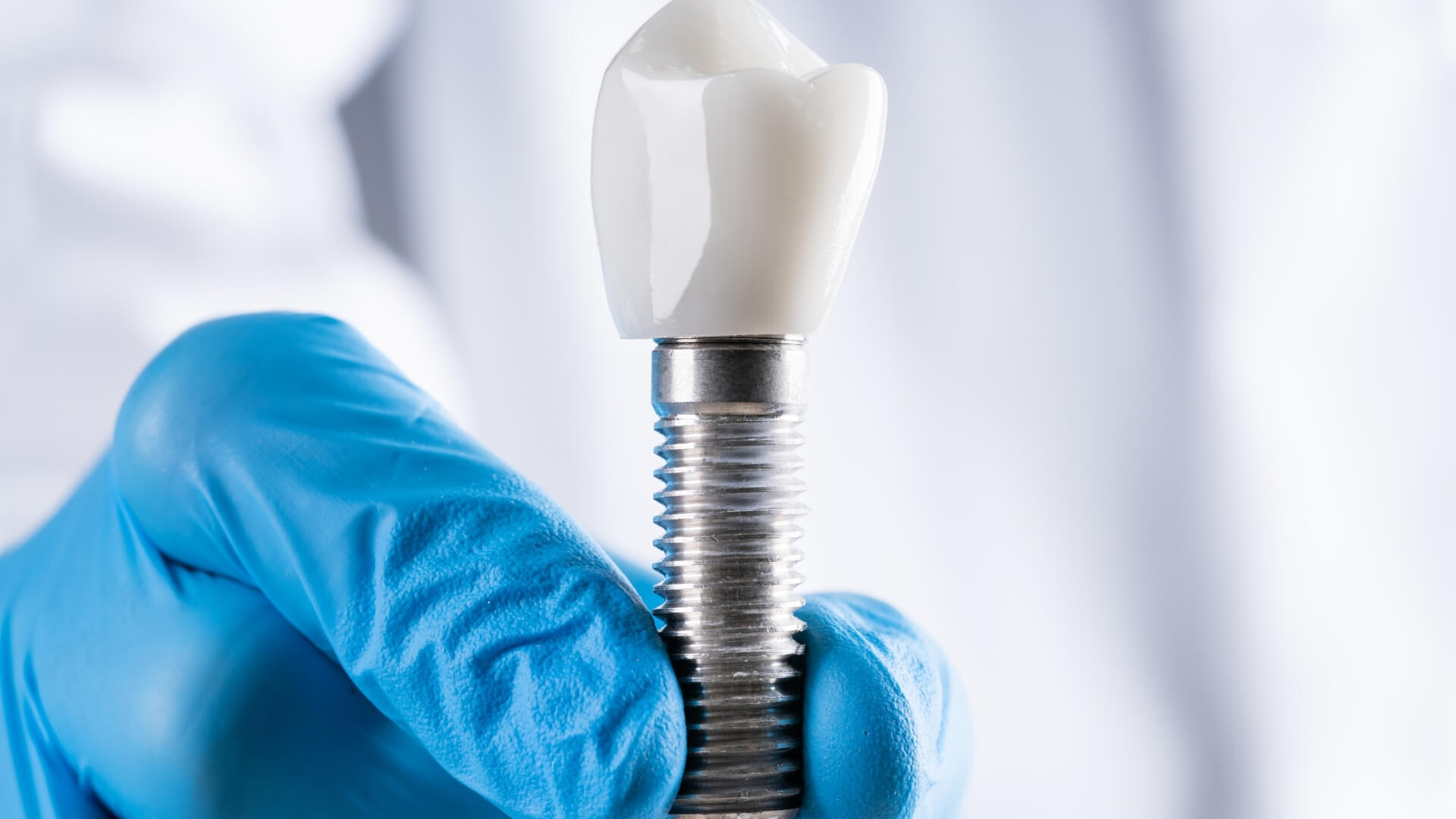 sgk implant tedavisini karsiliyor mu SGK İmplant Tedavisini Karşılıyor mu?